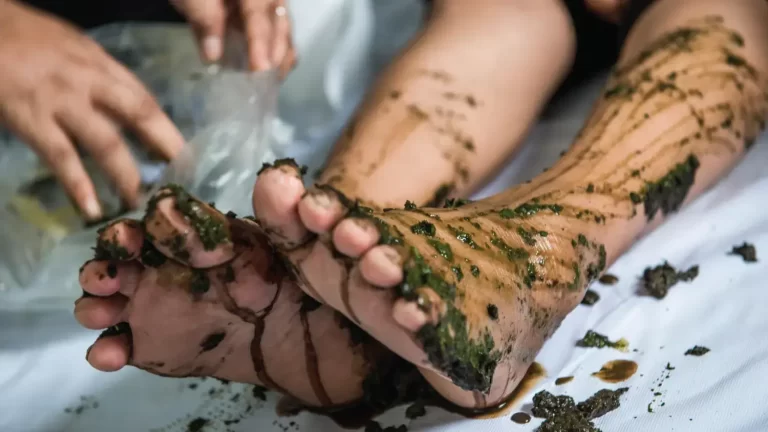 How to Heal Minor Wounds Naturally Ayurvedic Cure Hub